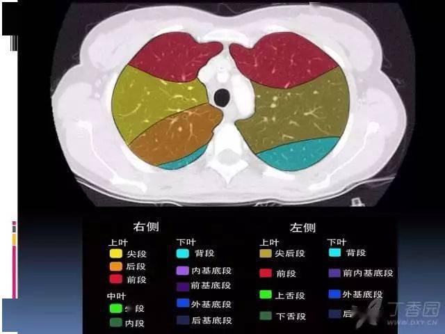 ct入门丨肺叶分段ct高清图谱