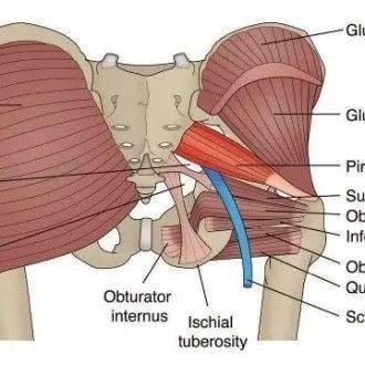 什麼是梨狀肌綜合徵