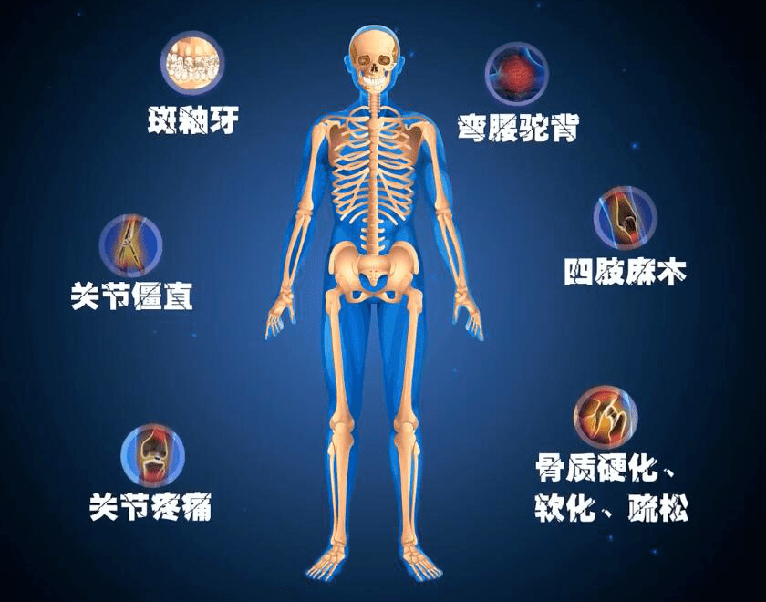 兴文县通过省级燃煤污染型地方性氟中毒消除验收