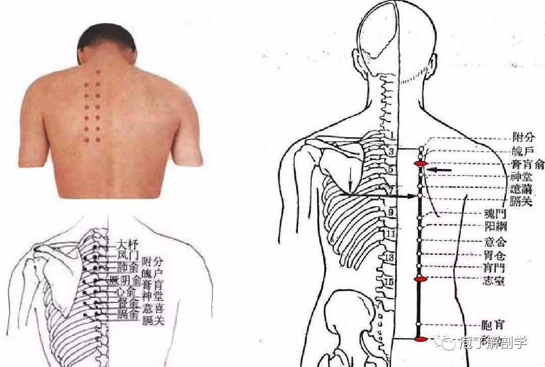 腰椎间盘突出症的针灸治疗