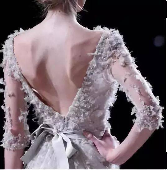 美背杀手翼状肩胛