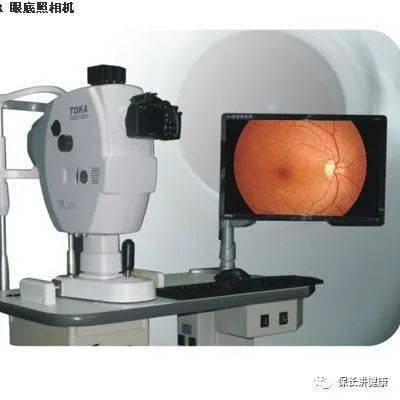眼睛:比起选眼底镜检查我还是选择眼底照相?_手机搜狐网