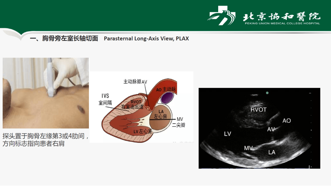 臨床指南與知識更新圍術期心臟超聲基本切面及應用