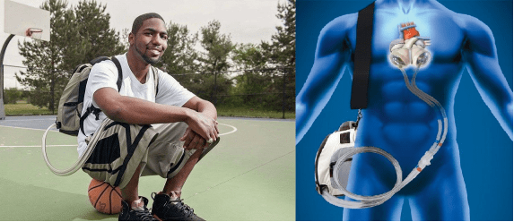 他们的心脏装在背包里