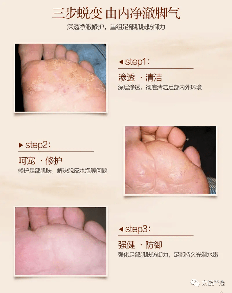 日本国宝马油告别皮肤皲裂脚气有效滋润双脚