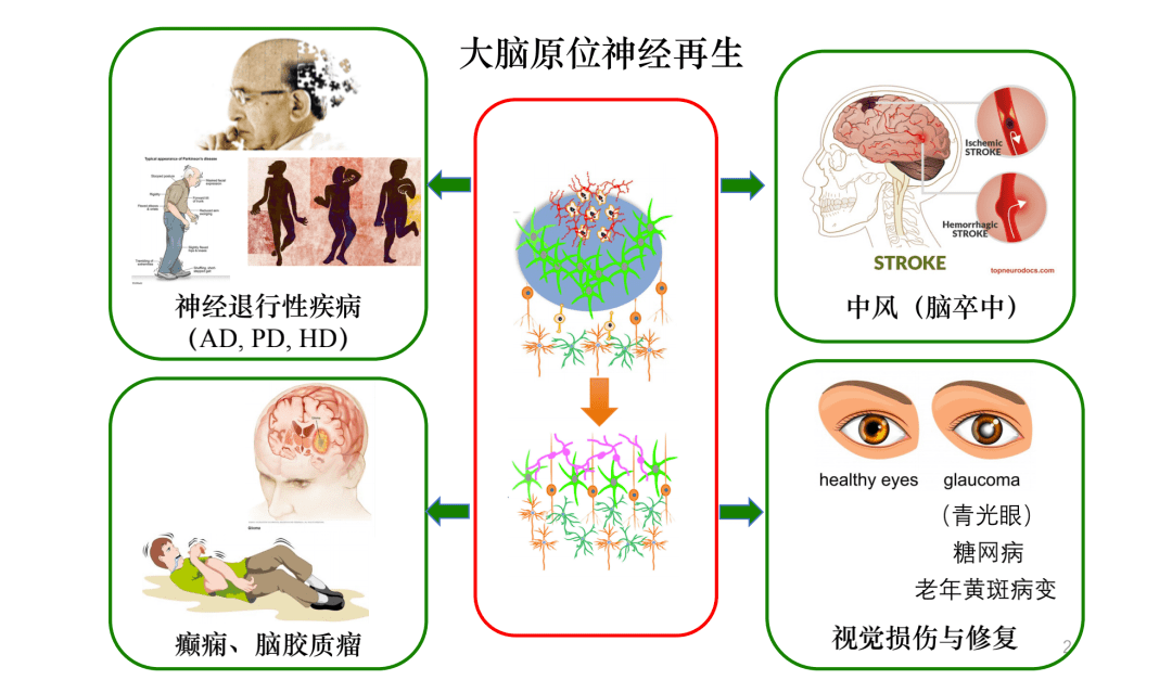 大脑修复世纪难题,暨大陈功团队攻克了!成功逆转胶质疤痕_神经元