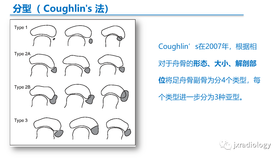 副舟骨分型图片图片