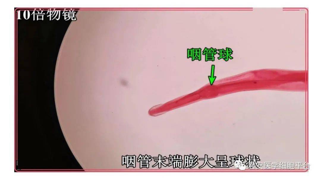 蛲虫及其虫卵之美图