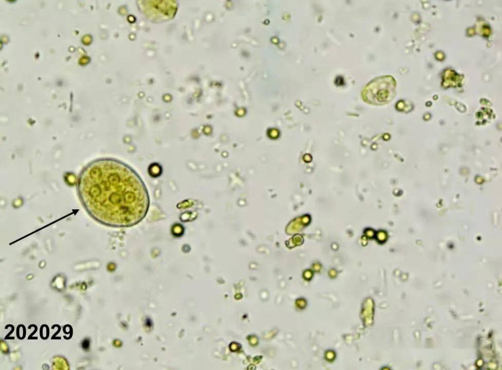 2020年广西临床形态学检验室间质量评价样本(第二次)_手机搜狐网