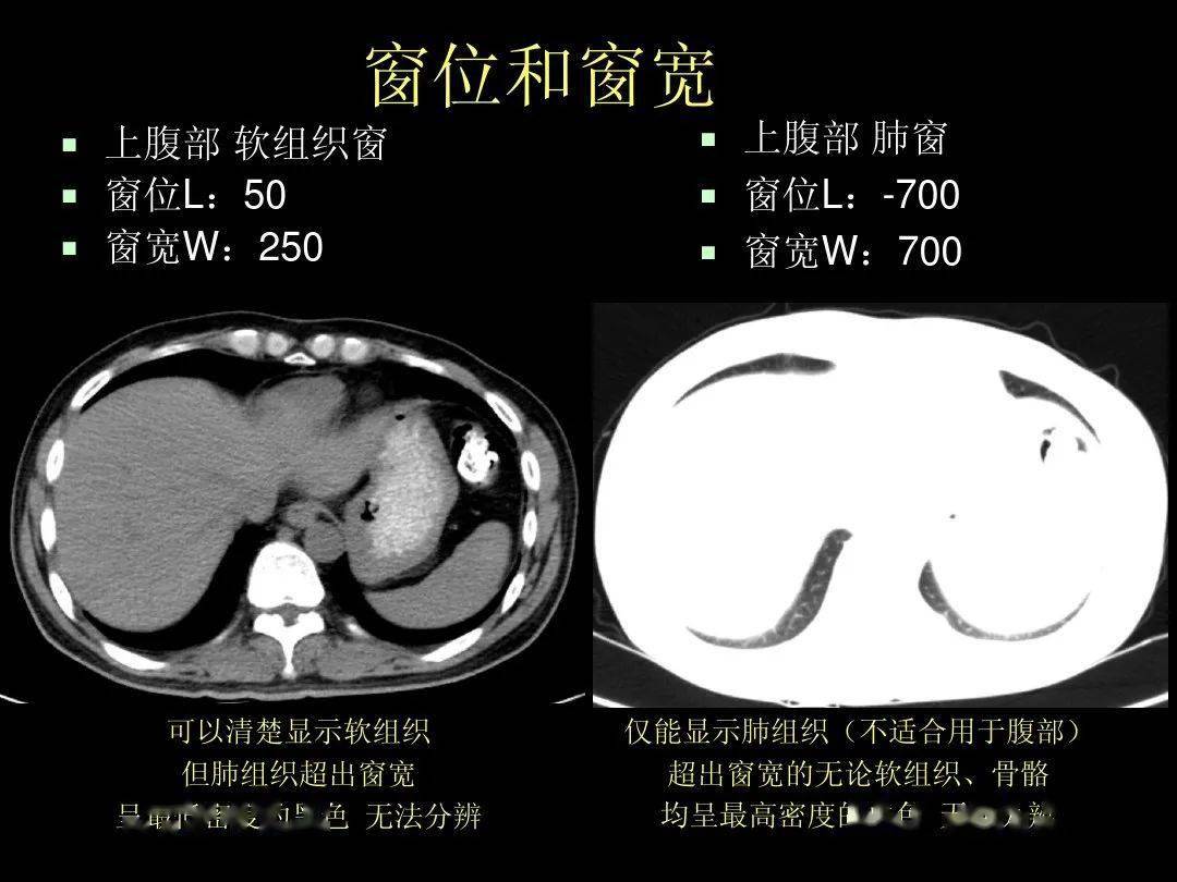 精品高清圖譜腹部ct應用入門必備