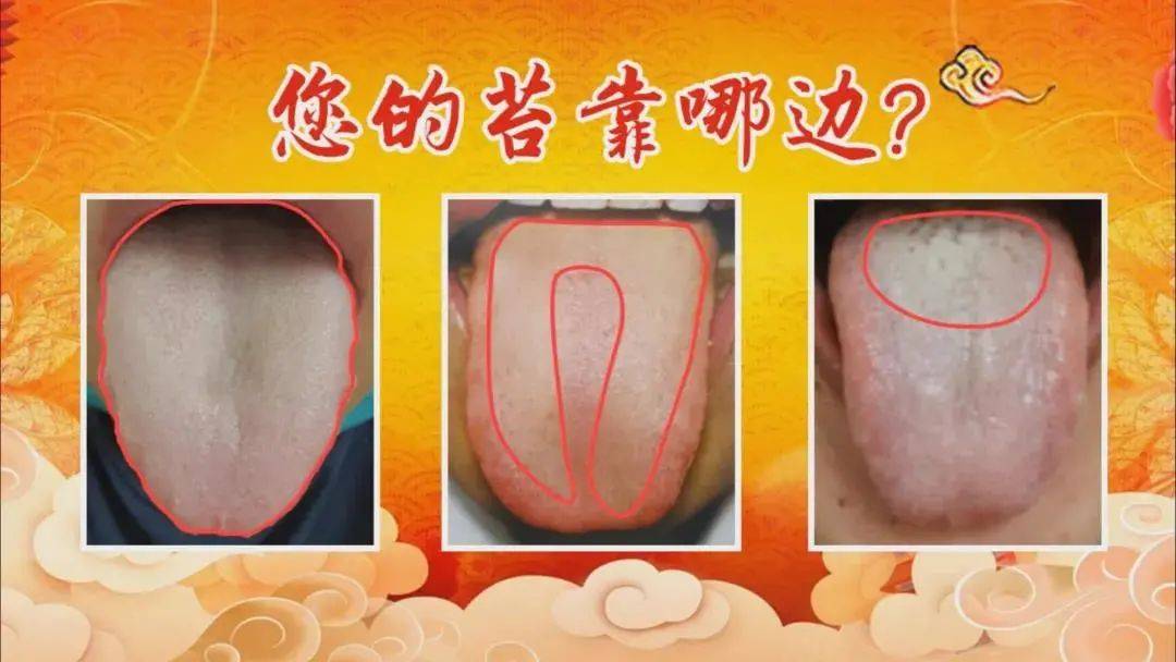 整个舌面都是湿湿的,稍微有一点点的腻,称为水滑苔,它是疾病初期的