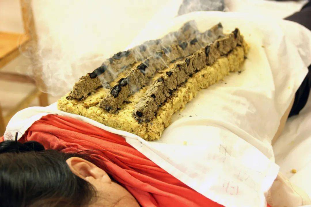 冬补三九温阳驱寒三九天灸优惠活动来啦