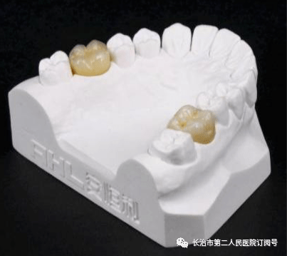 【二院医生说】牙齿掉了怎么办?_义齿