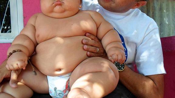 印度最胖的小男孩从20斤长到了390斤惊呆