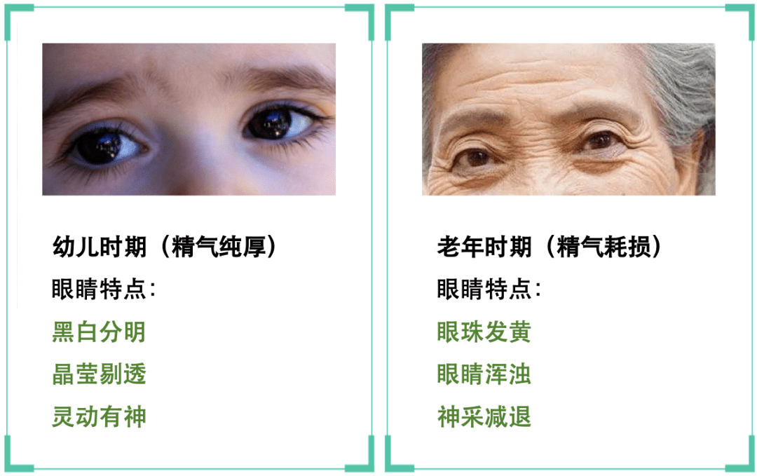 预健你丨目诊“看”出你的“郁闷”-搜狐大视野-搜狐新闻