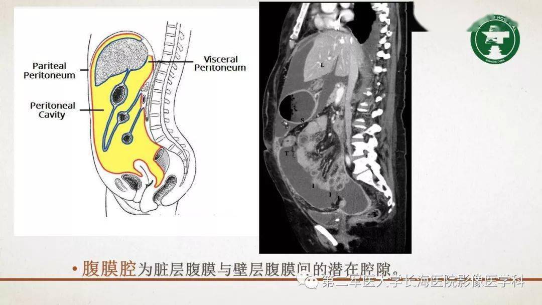 腹膜相关结构的影像解剖