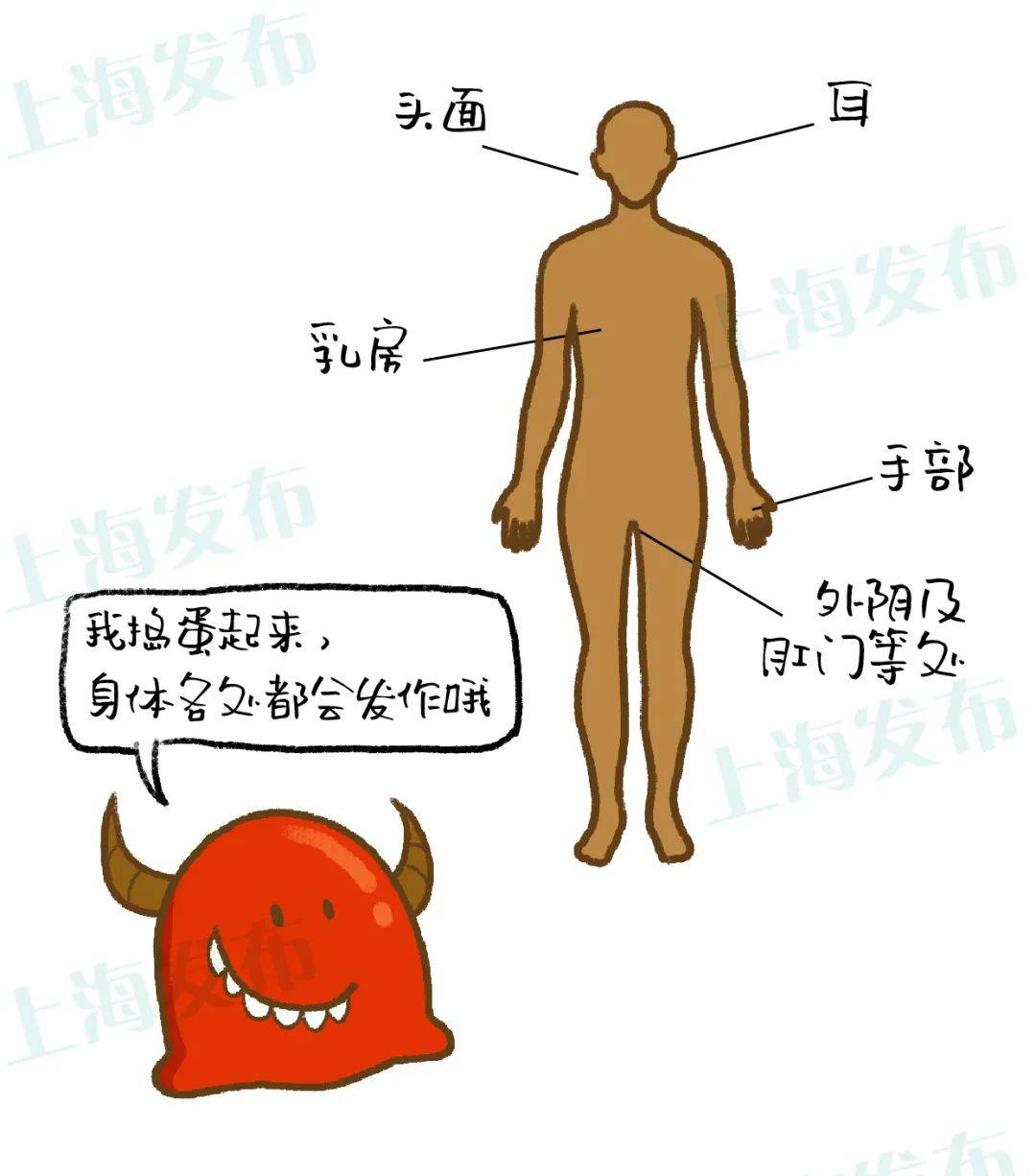 【名医】湿疹是免疫功能的混乱,怎样让ta远离你?