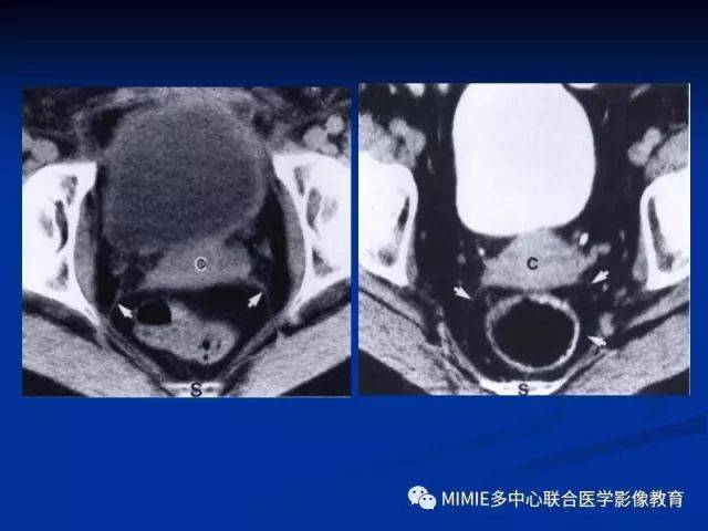 女性生殖系統正常解剖及表現