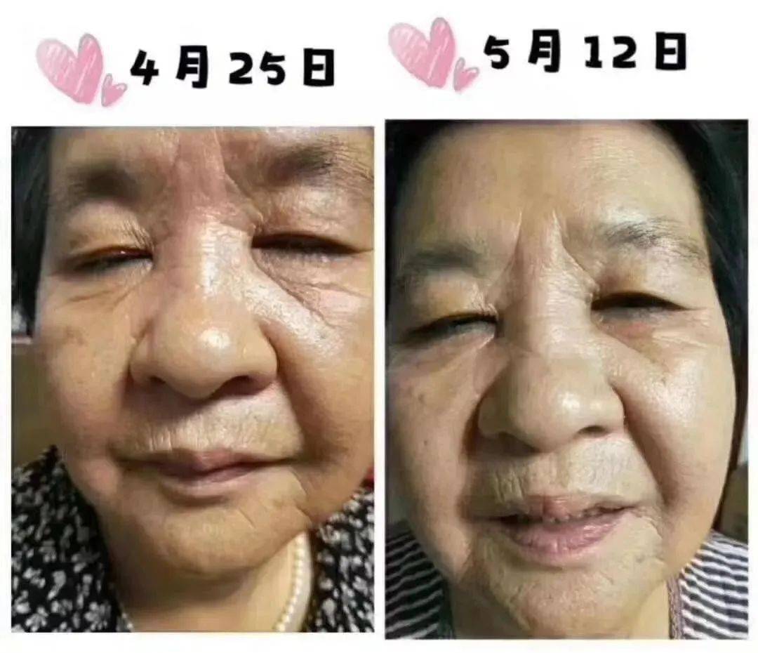 那些长期喝胶原蛋白肽的人最后变成这样了