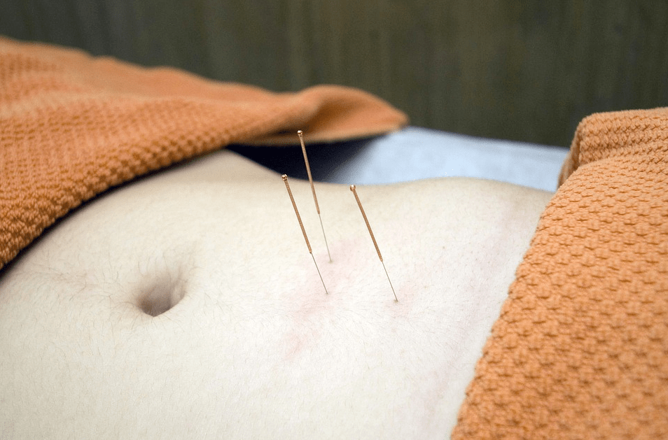 20岁的年龄,50岁的肩颈,咋整?_针灸