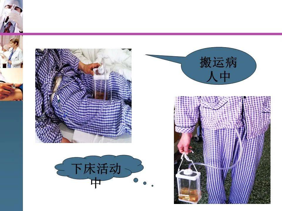 ppt管道护理及滑脱的处理