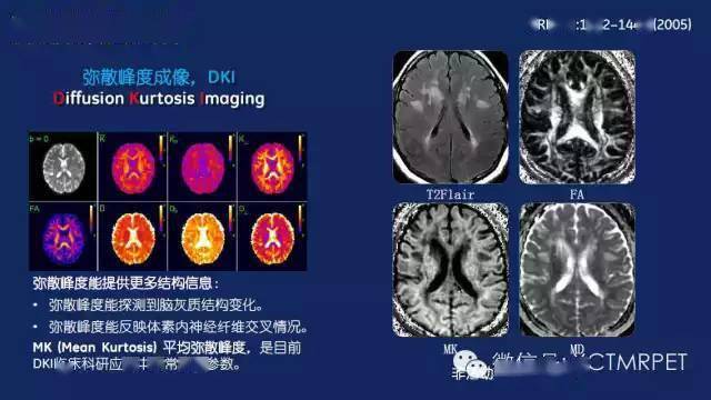 神经系统磁共振检查到底有哪些序列都在这里