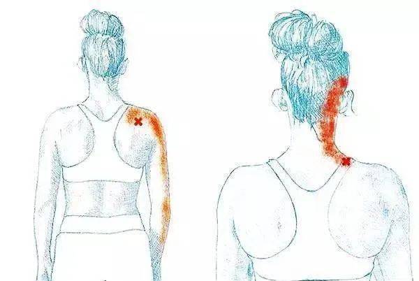 一文说清l手部麻木的7种常见病因、如何鉴别及治疗-搜狐大视野-搜狐新闻