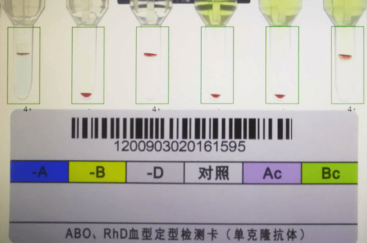 血型检测卡结果图图片
