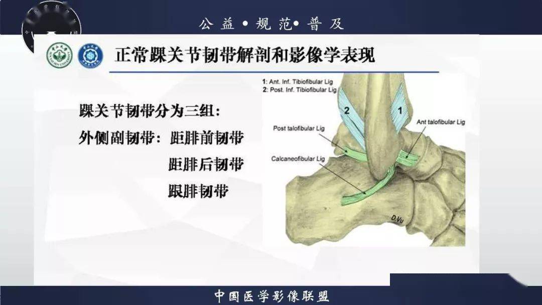 踝关节解剖及损伤mri诊断