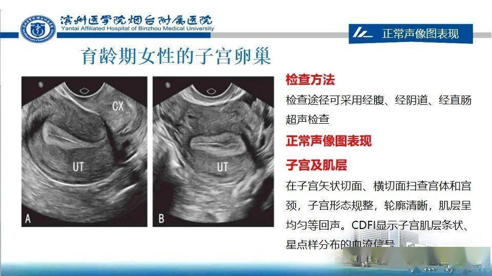 女性生殖系統解剖與婦科超聲檢查