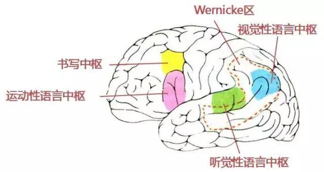 警惕长在运动区的脑肿瘤:左侧肢体麻木无力,竟查出脑肿瘤