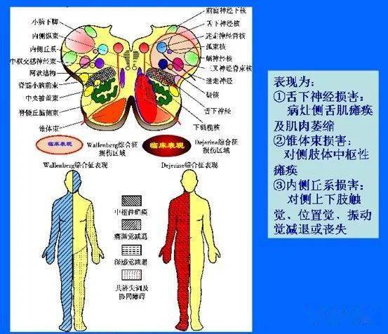 一例罕见的,以前未曾诊断过的长节段脊髓病变