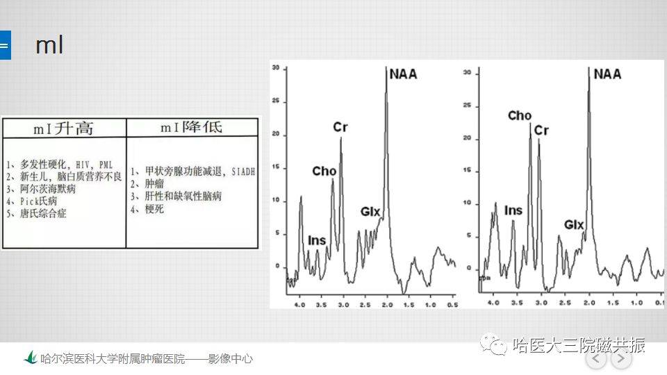 磁共振波谱成像mrs的原理及临床应用