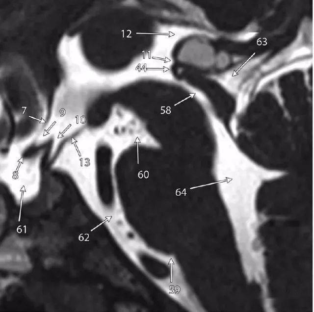 8,腦脊液腔(csf spaces)7,中腦/腦幹(midbrain/brainstem)6,動靜脈