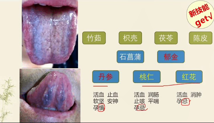 舌诊不再难学| 沈氏女科临床实用舌诊带你提高临床诊断水平!_课程