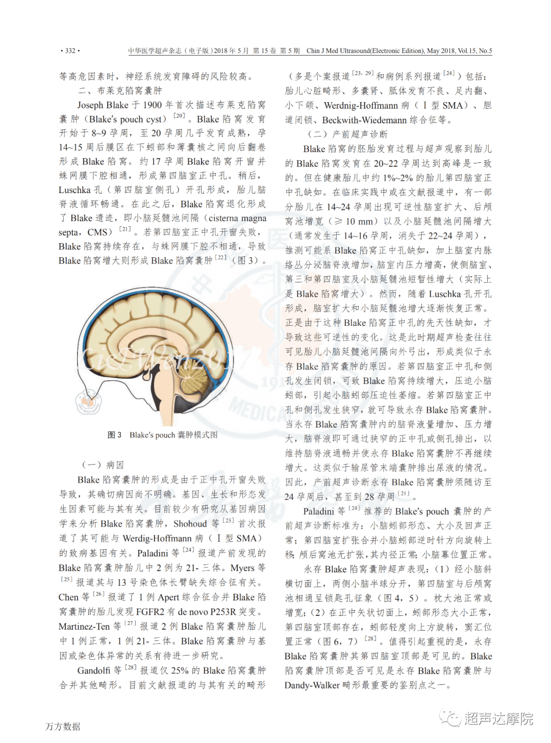 颅内囊性结构室管膜下囊肿布莱克囊肿韦氏腔中间帆腔产前超声报告与