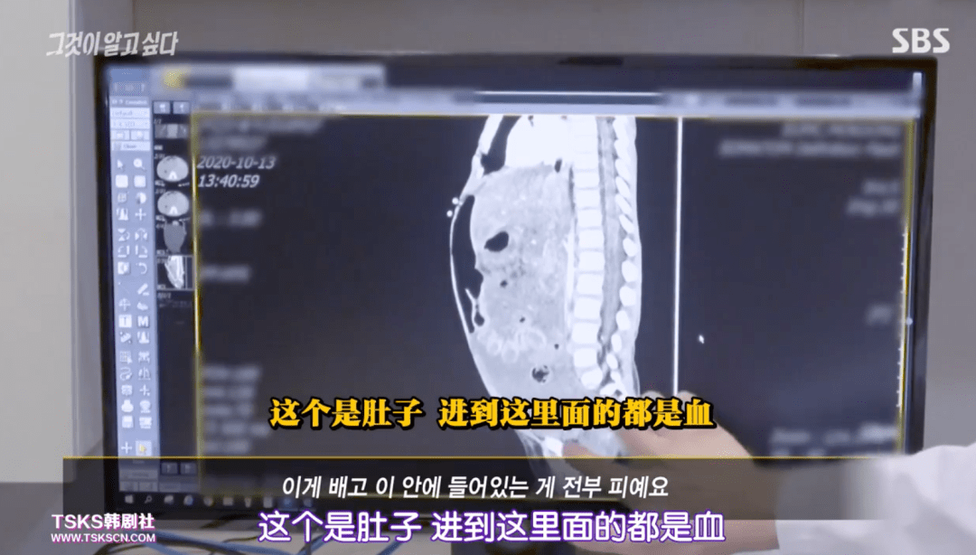 她活活踩死16个月女婴后,一边假哭一边开心点外卖_郑仁