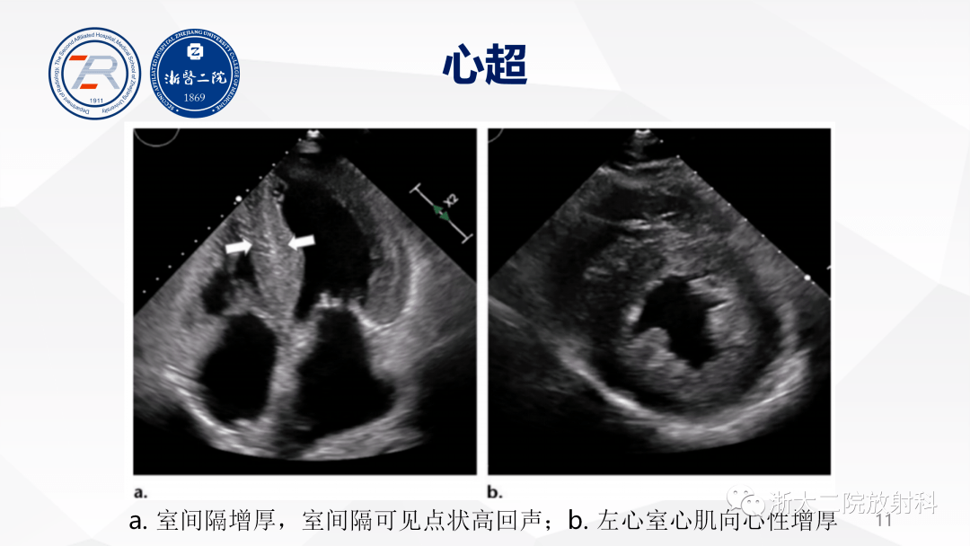 主持并参与多项省级及国家级课题主要方向为心血管系统影像诊断及鉴别