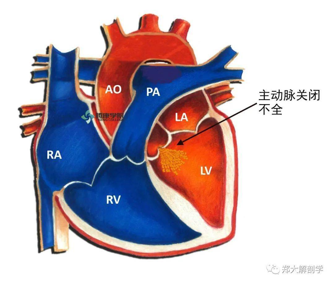 胸廓内动脉图片