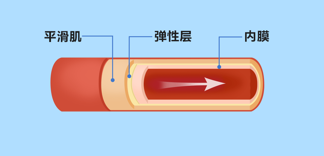 好好的血管,怎么就堵了?_动脉