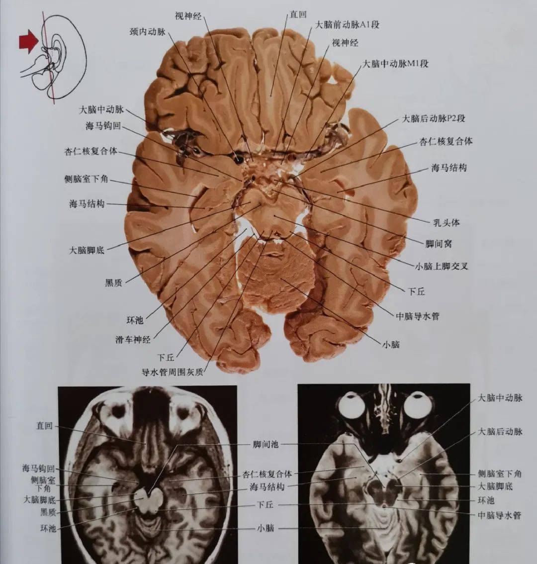 临床神经解剖图谱(断层影像 切片)_平面