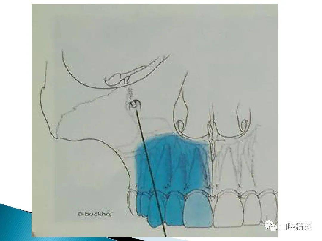 口腔麻醉注射要点