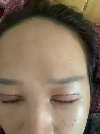 滕州一整形医院的事美女顾客被毁容都没法见人了