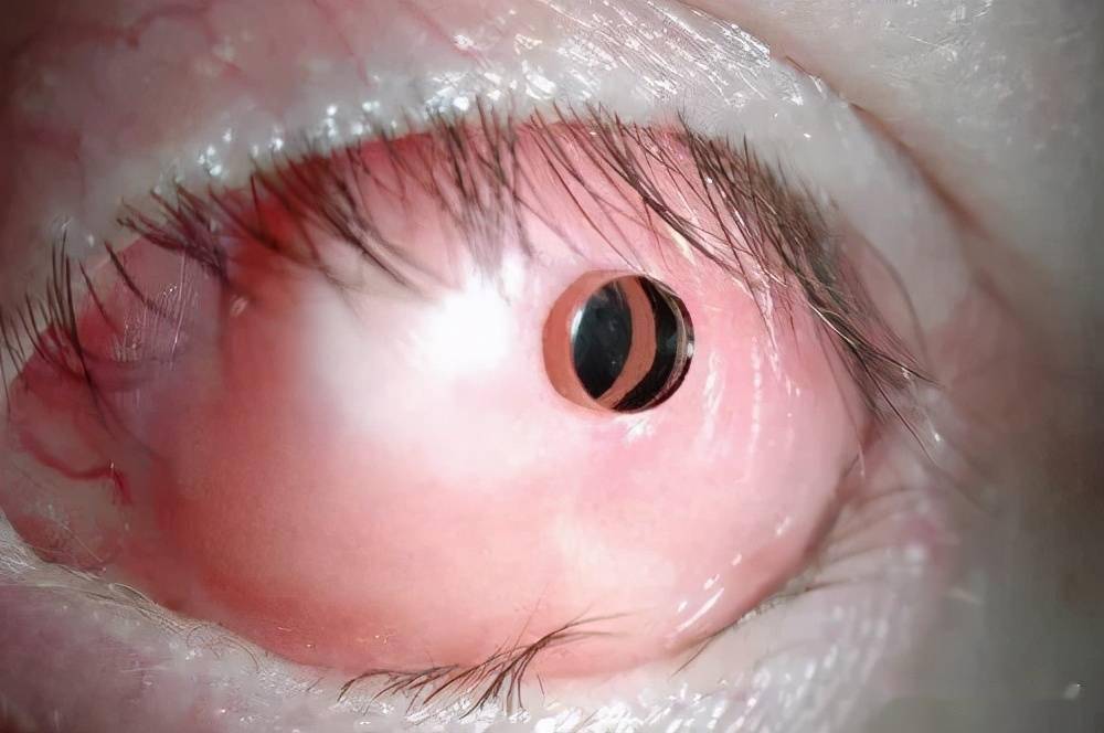 有种重见光明的方式叫以牙换眼