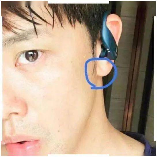 耳朵上有折痕代表什么图片