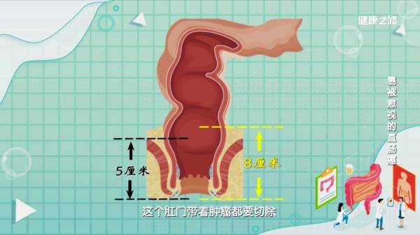 女性直肠是指哪个部位图片