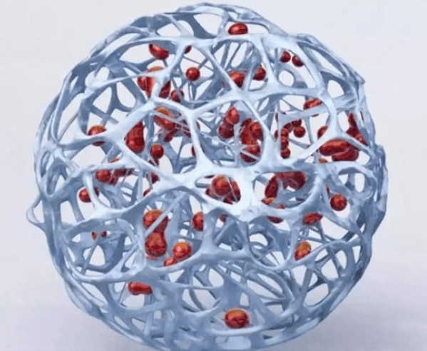 旬阳县医院成功开展安康市首例原发性肝癌载药微球tace治疗