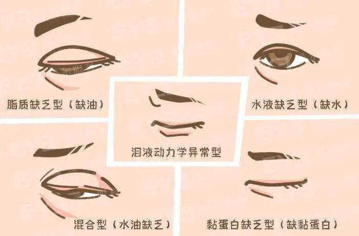 眼睛的类型图解 acfa6b945297423dbf872c563acdcd82.jpeg