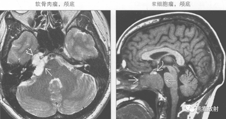 鉴别诊断