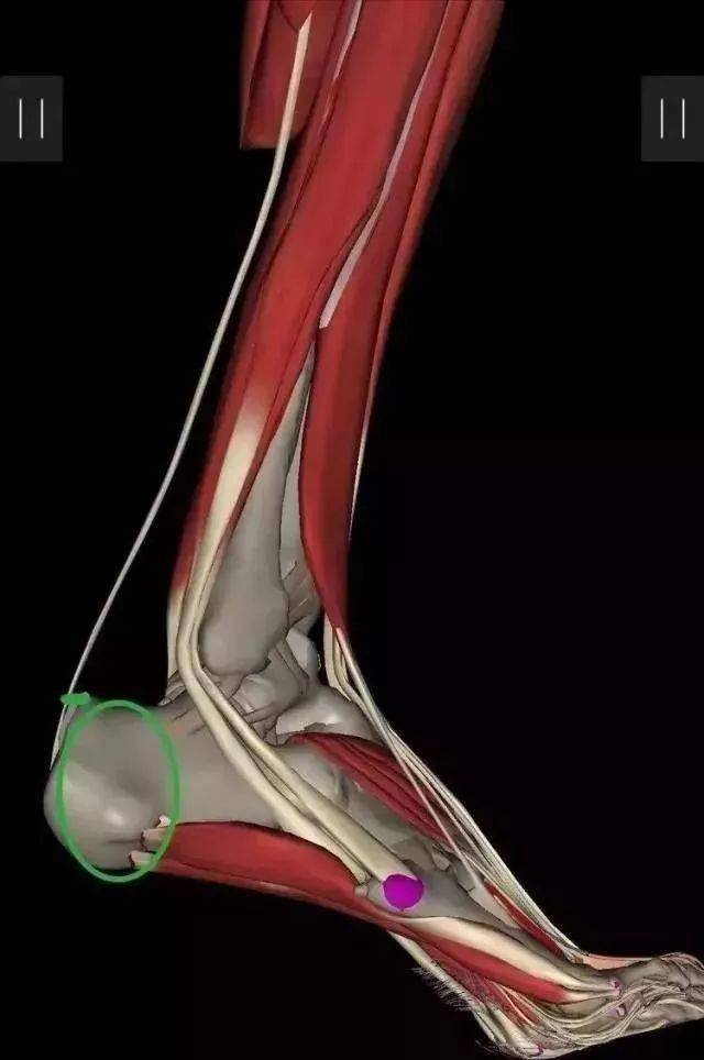 跟腱后滑囊炎痛点图图片